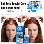 Sumifun Hair Growth Cream – Anti Hair Loss & Regrowth Cream for Men & Women