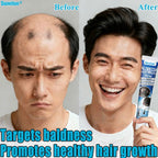 Sumifun Hair Growth Cream – Anti Hair Loss & Regrowth Cream for Men & Women
