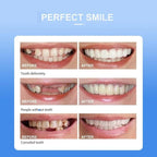 Removable White Teeth Veneers Covers Gaps, Yellow, Missing & Crooked Teeth - One Size Fits All, No Dentist Needed