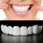 Removable White Teeth Veneers Covers Gaps, Yellow, Missing & Crooked Teeth - One Size Fits All, No Dentist Needed